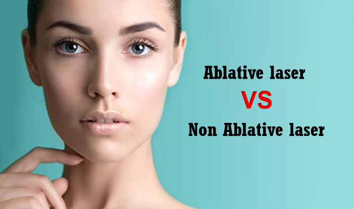 Hvad er forskellen på ablativ og ikke -ablativ laser?