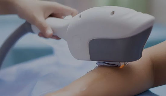 IPL laser maskine